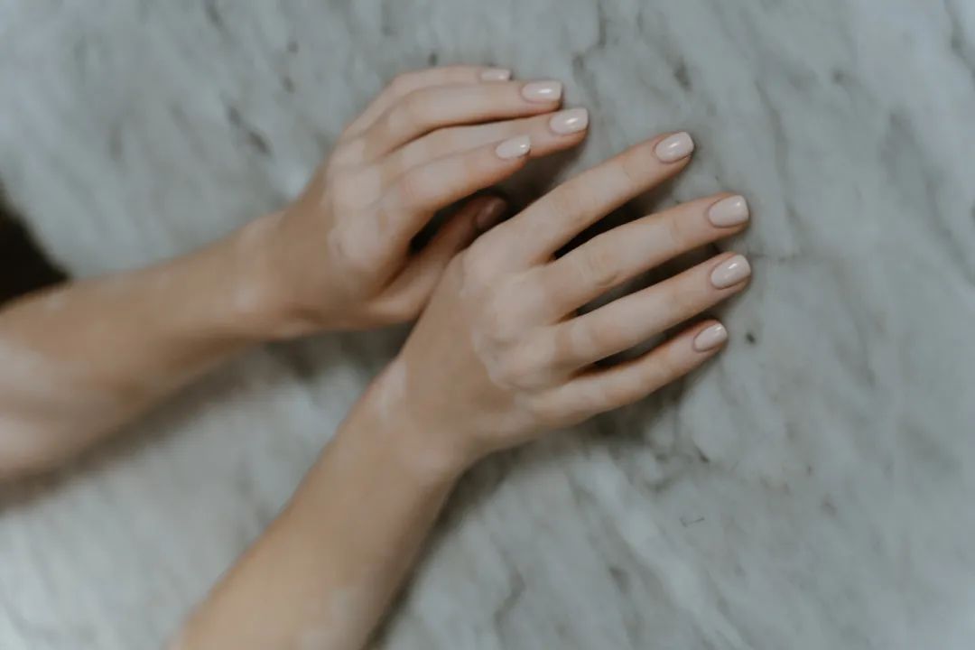 白癜风原创突破背后：一部历时六年的“失败简史”