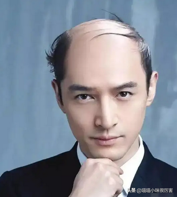 03,地中海发型谁都不好看