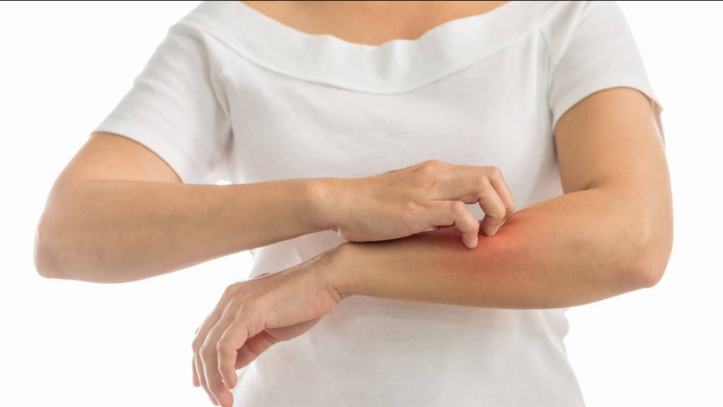 皮肤瘙痒,长疙瘩别不在意,这5种皮肤病在"兴风作浪"