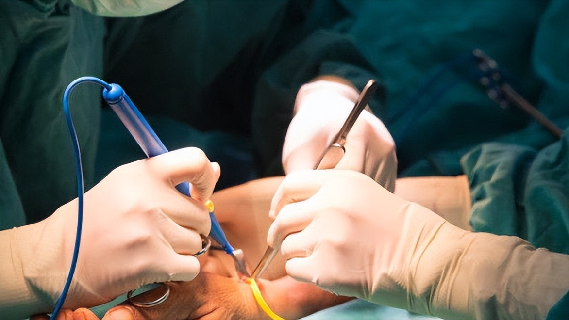 全麻手术是指将特定的麻醉药物通过一定的方式作用于患者的中枢神经