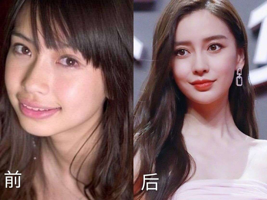 吴宣仪生图惹争议:脸肿下巴尖,整牙后她为什么变丑了?