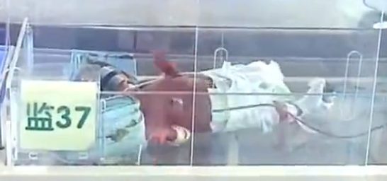 2013年海南病婴仅2斤重，治疗费压垮父亲，竟直接将孩子扔进河里