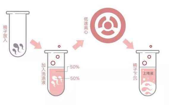 2019年，英国女子嫌人工授精太贵，购买工具自行操作，一次就成功