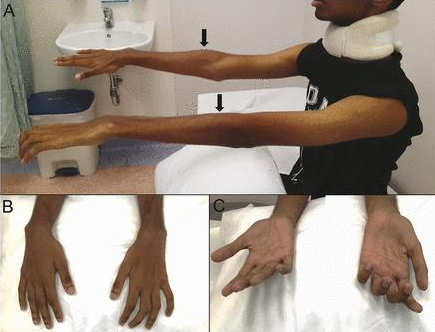 医生提醒:警惕"平山病"