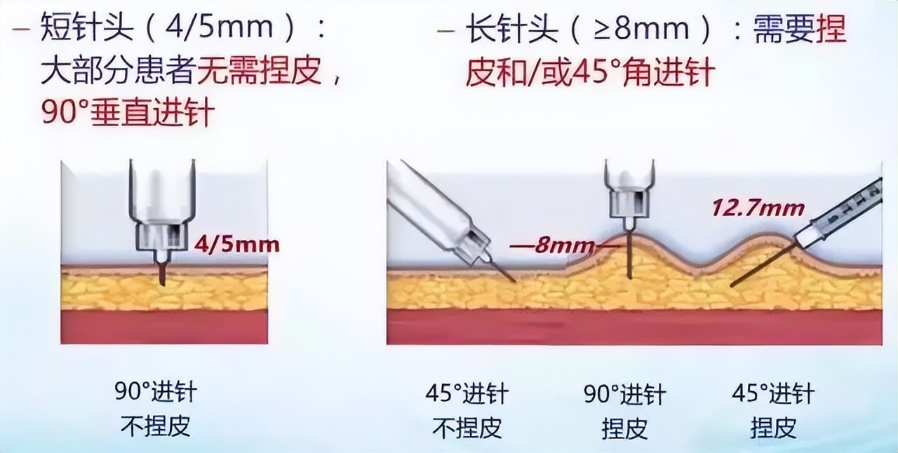 胰岛素笔的使用及储存（内附已降价的胰岛素制剂目录）