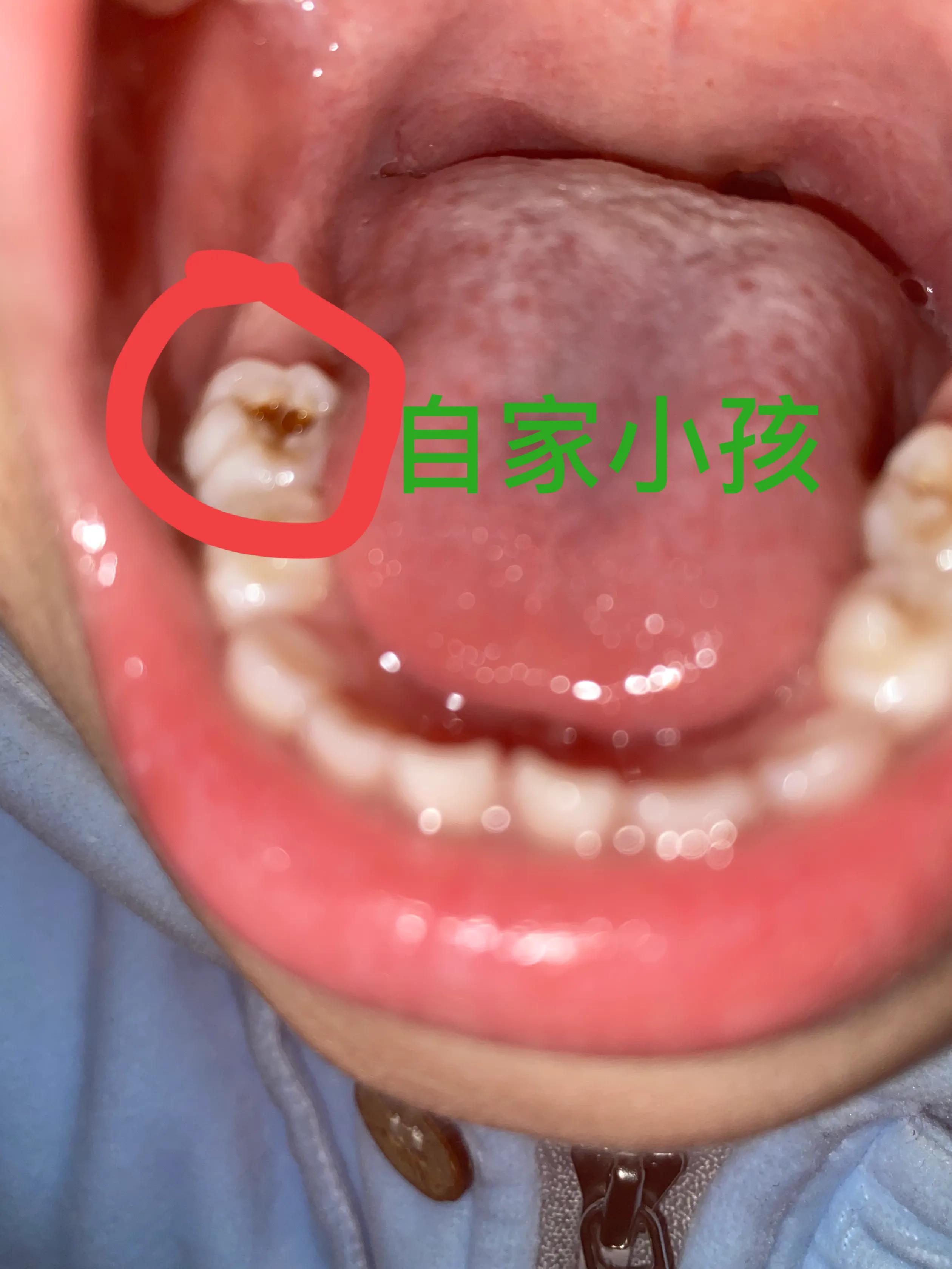 婴儿多久可以看灯光（新手爸妈含泪总结宝宝护牙经验）