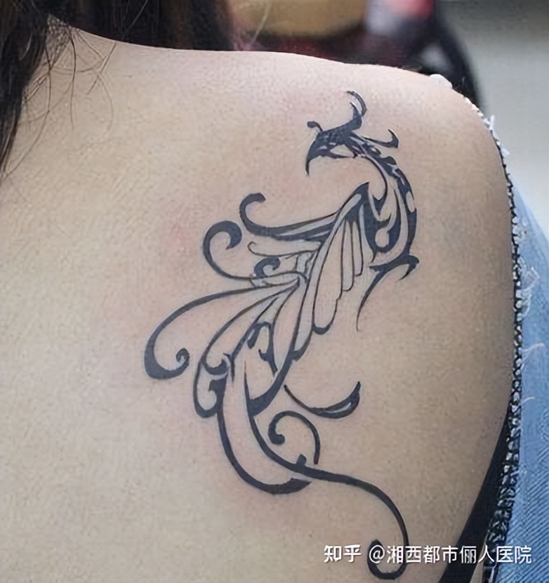 洗纹身的价格大概多少吉首俪人医院告诉你