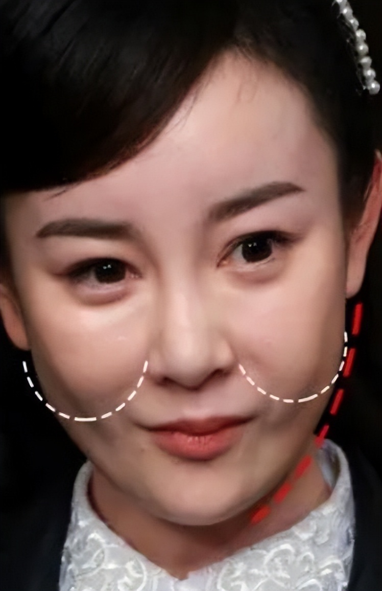 瘦到病态、整容成瘾，痴迷于少女人设，内娱的畸形审美太可怕