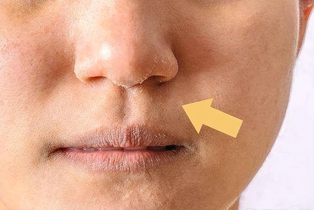 "鼻毛变白"是衰老前兆?医生:或与4个原因有关,男性应要注意