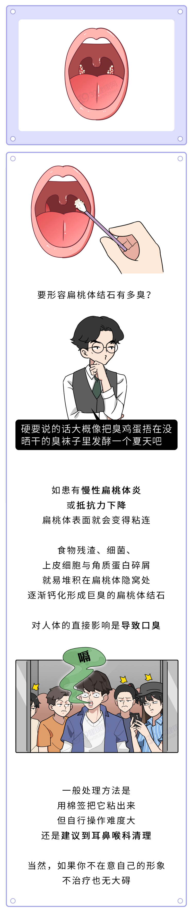 牙缝里软软发臭的黄泥是什么？为什么不能乱抠肚脐眼？终于懂了