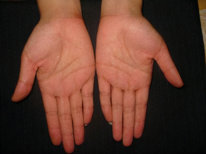 你双手指纹有几个螺手指指纹有几个螺