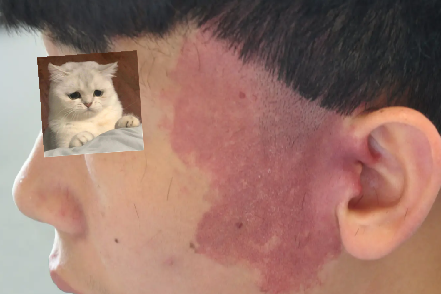 宝宝的胎记,可能与你孕期的磕碰有关,准妈妈一定要多加小心