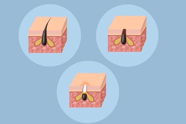 女性长期脸色蜡黄，调理不好？许是搞错方向了，子宫“脏”是元凶