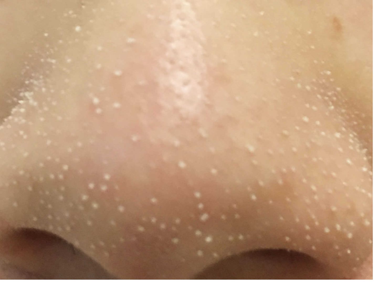 為什么上完粉底液以后，鼻子上有很多白點(diǎn)點(diǎn)？