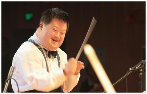 为什么患有唐氏综合征的人,没有遗传父母的外貌,长相都差不多?