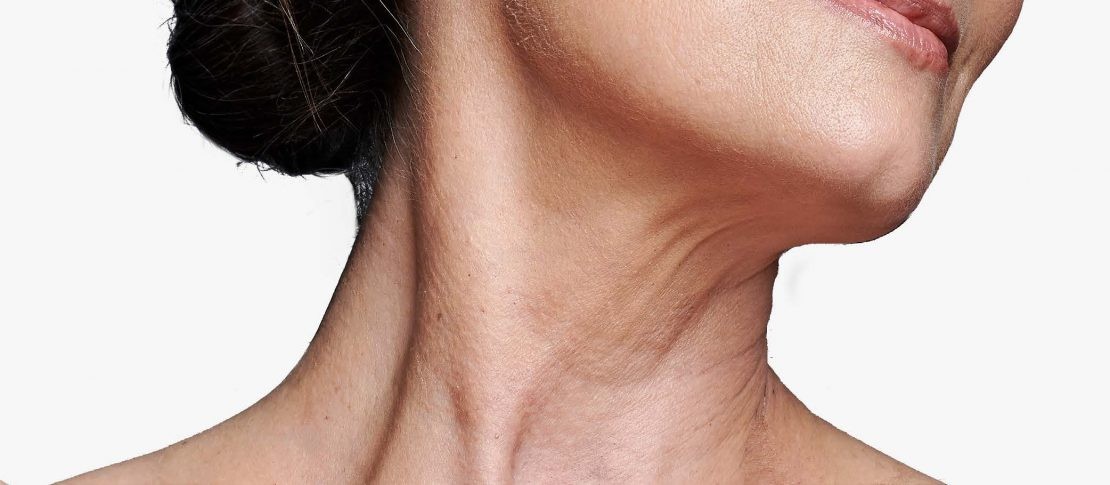 為什麼頸部皮膚會下垂？ 六個生活習慣可以幫助保持皮膚緊緻和滑潤