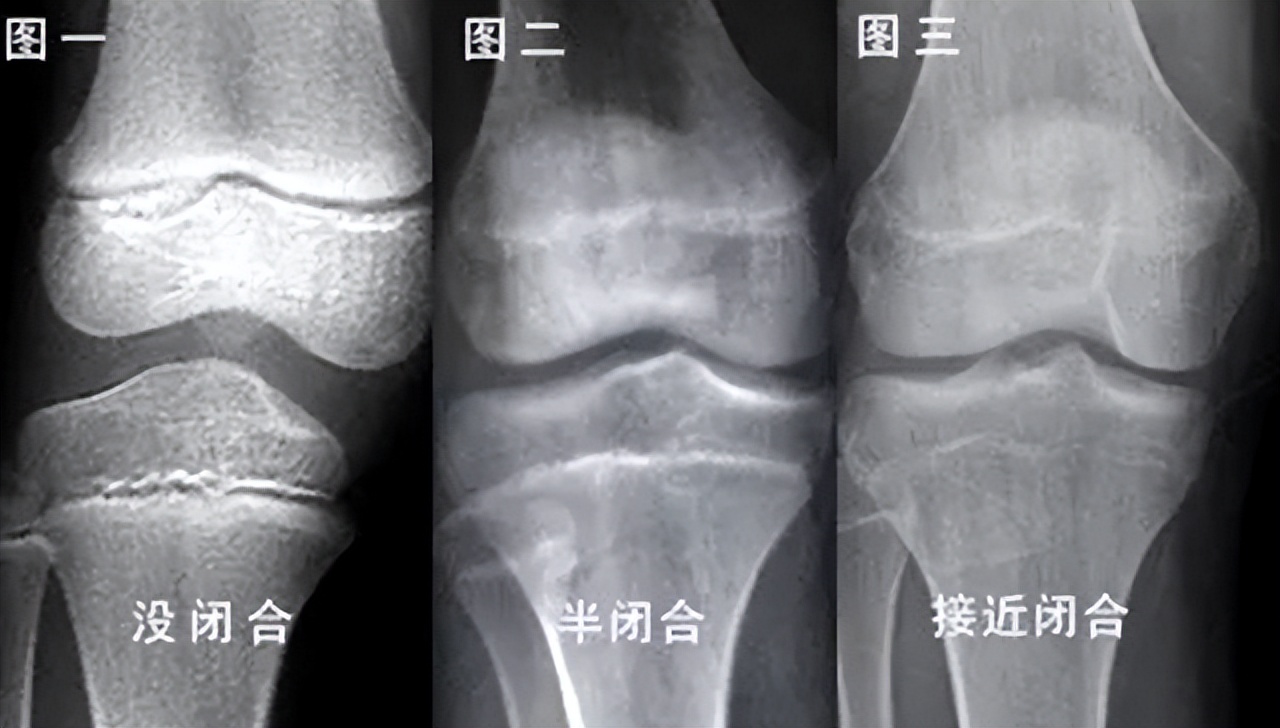 身高遵循“立七坐五盘三”？孩子将来高不高，几个部位一目了然