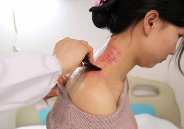 刮痧究竟是真养生，还是伪科学？刮出来的“痧”，到底是什么？