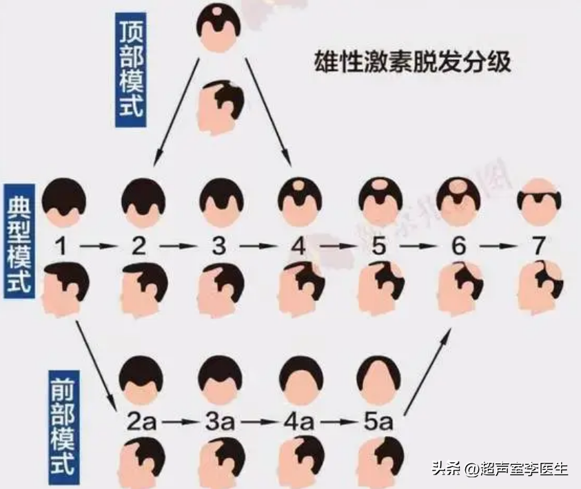 身体“缺”什么会大把掉头发？原因告诉您，秀发自己长出来