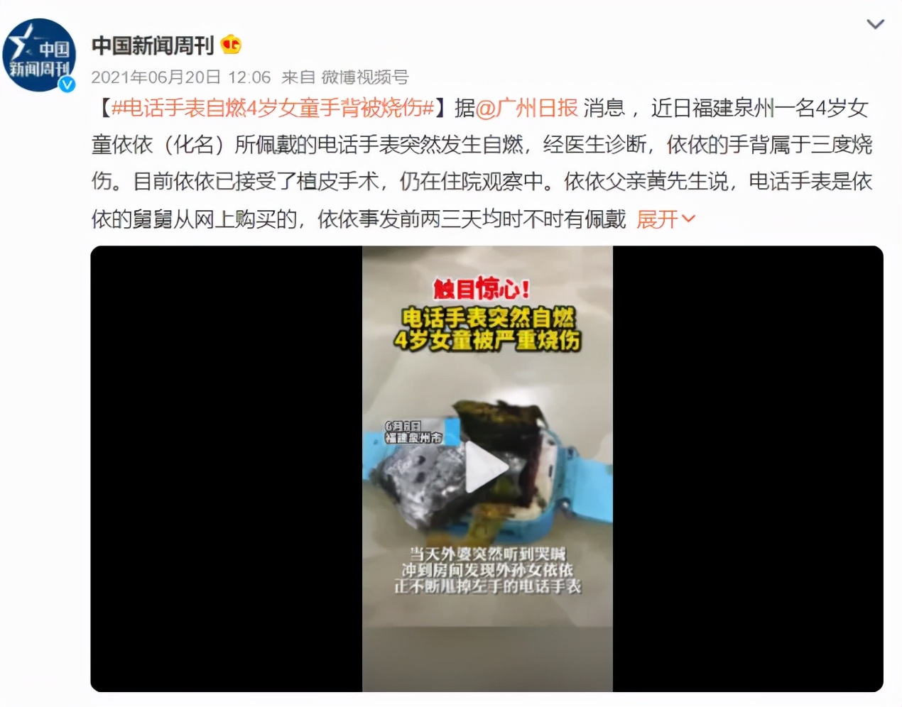 突发自燃，4岁女童被严重烧伤！儿童电话手表还能给孩子买吗？