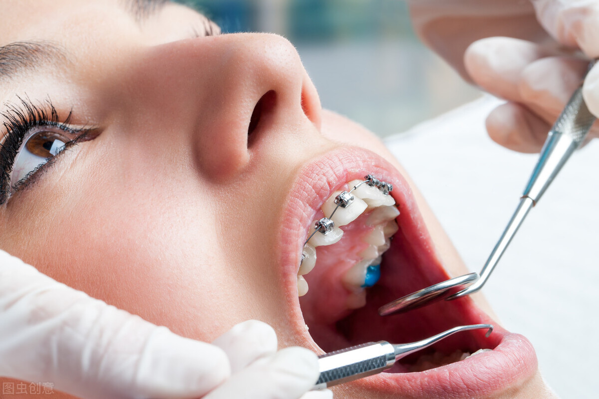 口腔医院拍牙片多少钱为什么现在看牙病都必须拍片
