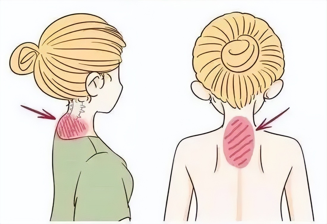 4招教你科学缓解