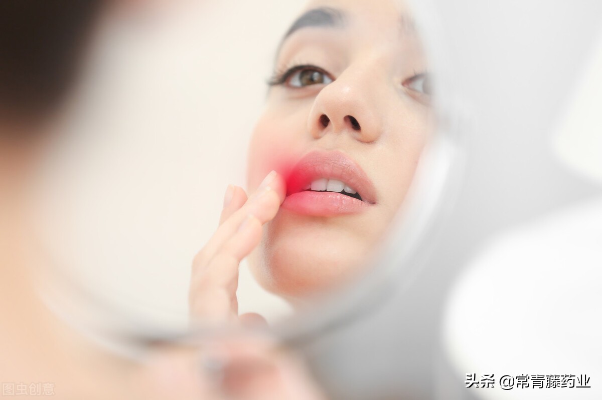 嘴唇上经常冒出小水疱，总是说上火？医生：告诉你真相