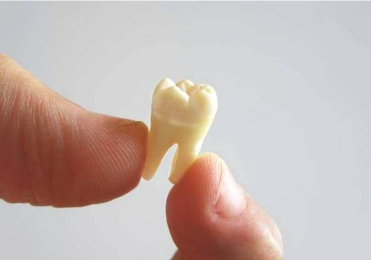 牙齿松了如何恢复？这5招简单又有效！专家：早知早受益