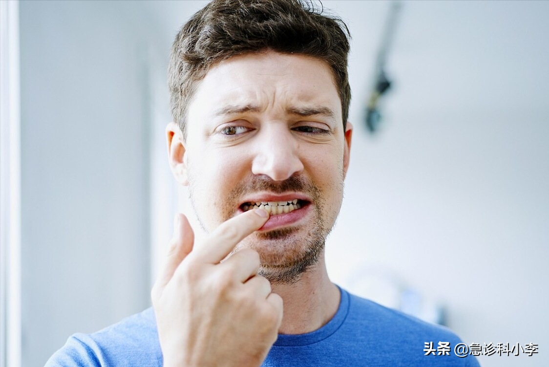 牙缝里的牙结石，如何清除干净？3个办法是不少人的选择