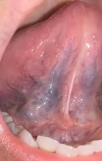 《对手》：硝酸甘油能杀人吗？