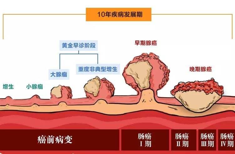 肠内若长了“息肉”，身体会有什么症状反应？