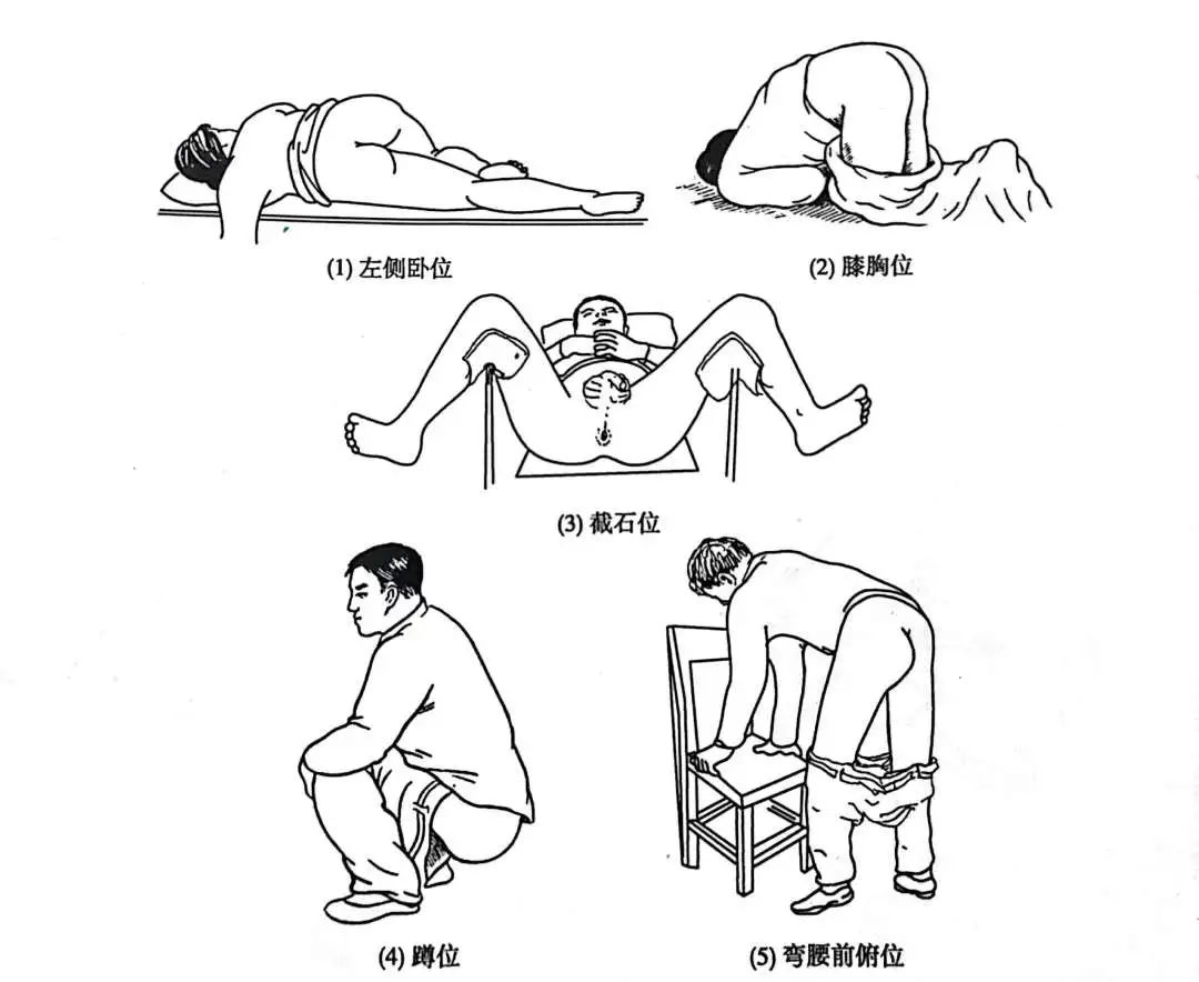 直肠肛管检查体位丨《外科学》还好不是截石位,哈哈