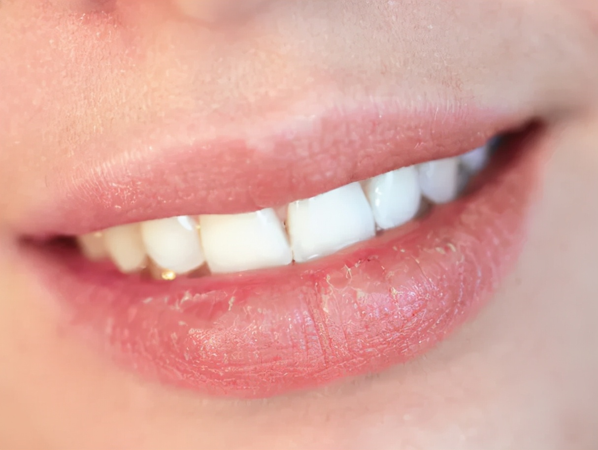 嘴唇一干就涂唇膏吗？涂的时候要注意，涂不对，会“烂嘴”