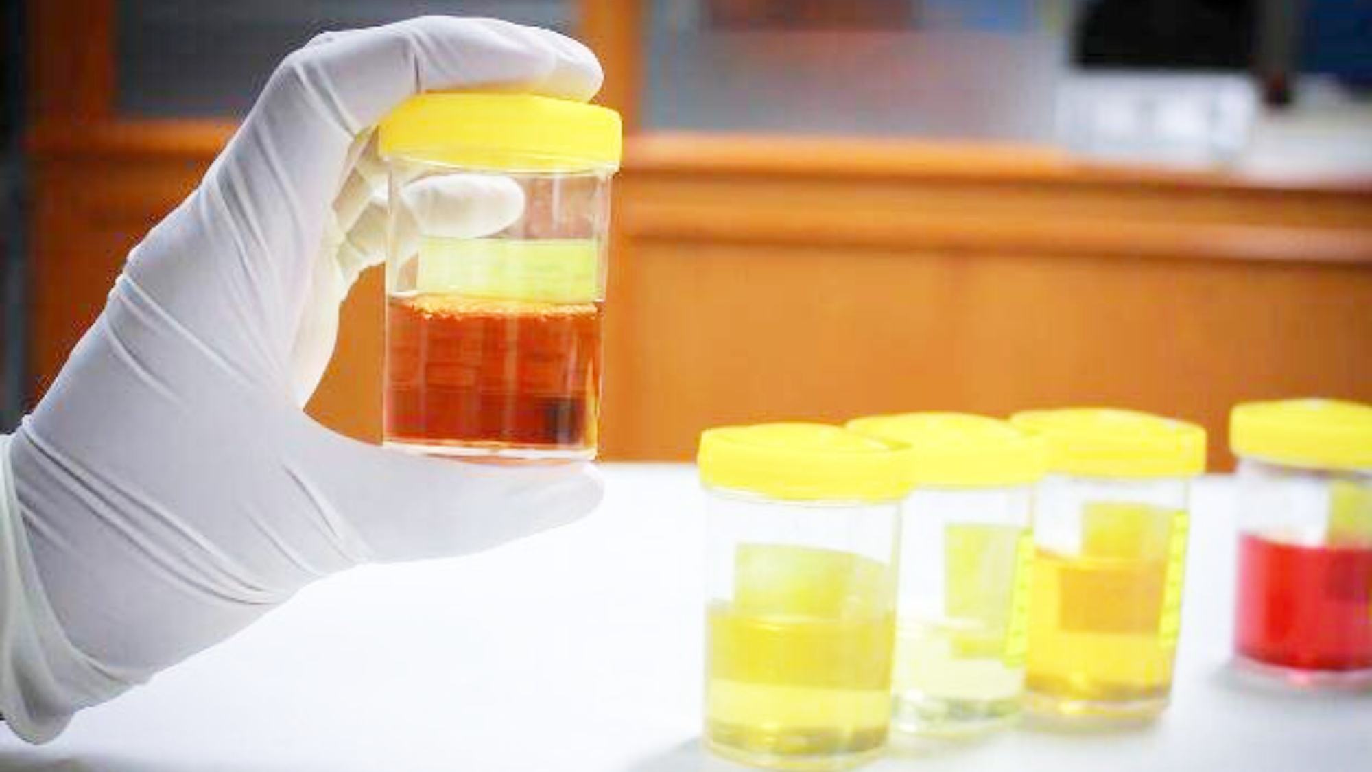 肾好不好可以看看脚，6表现说明肾可能异常，做好3件事，养好肾