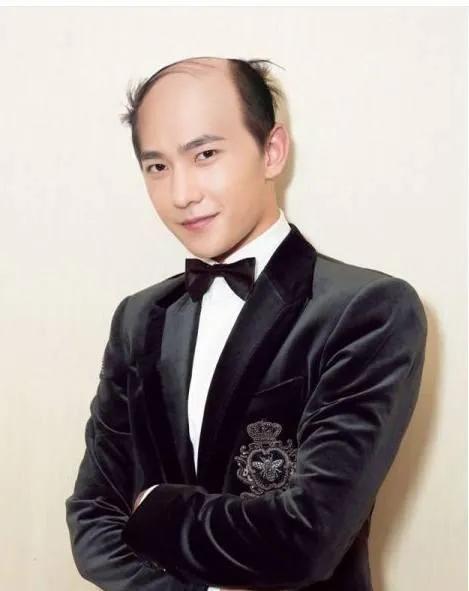 如果明星秃顶了，你还觉得他们帅吗？