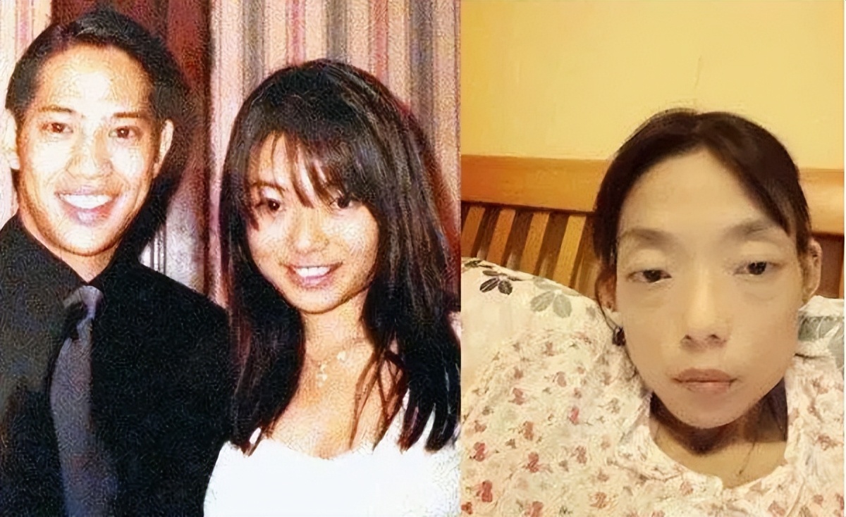 瘦到病态、整容成瘾，痴迷于少女人设，内娱的畸形审美太可怕