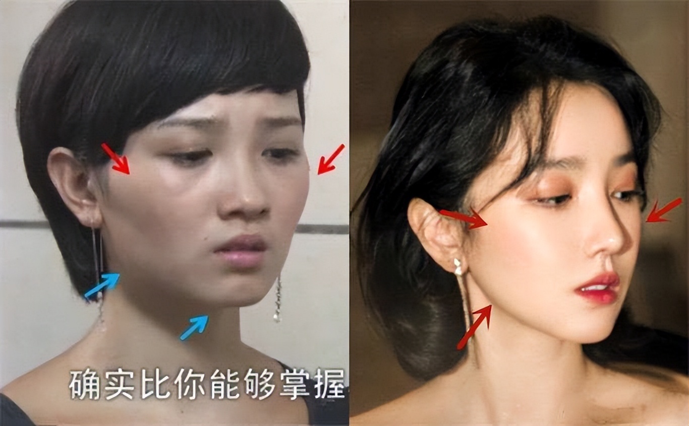 瘦到病态、整容成瘾，痴迷于少女人设，内娱的畸形审美太可怕