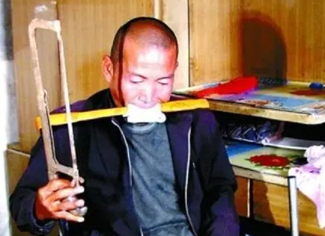 河北硬汉郑艳良，为省下百万医疗费用，忍着疼痛锯断双腿求生