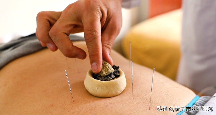 中医药特色治疗有效又暖心