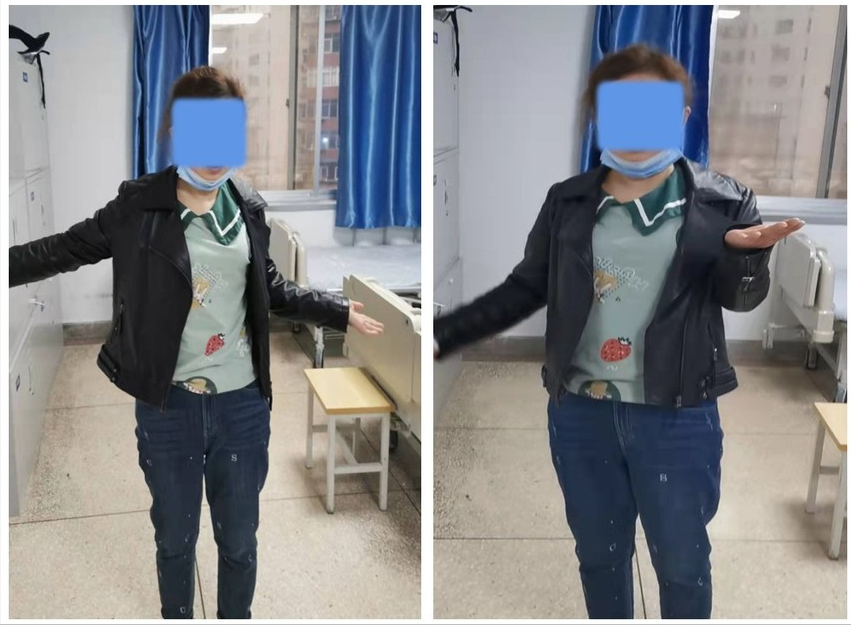 提拉重物时要当心 慎防臂丛神经炎