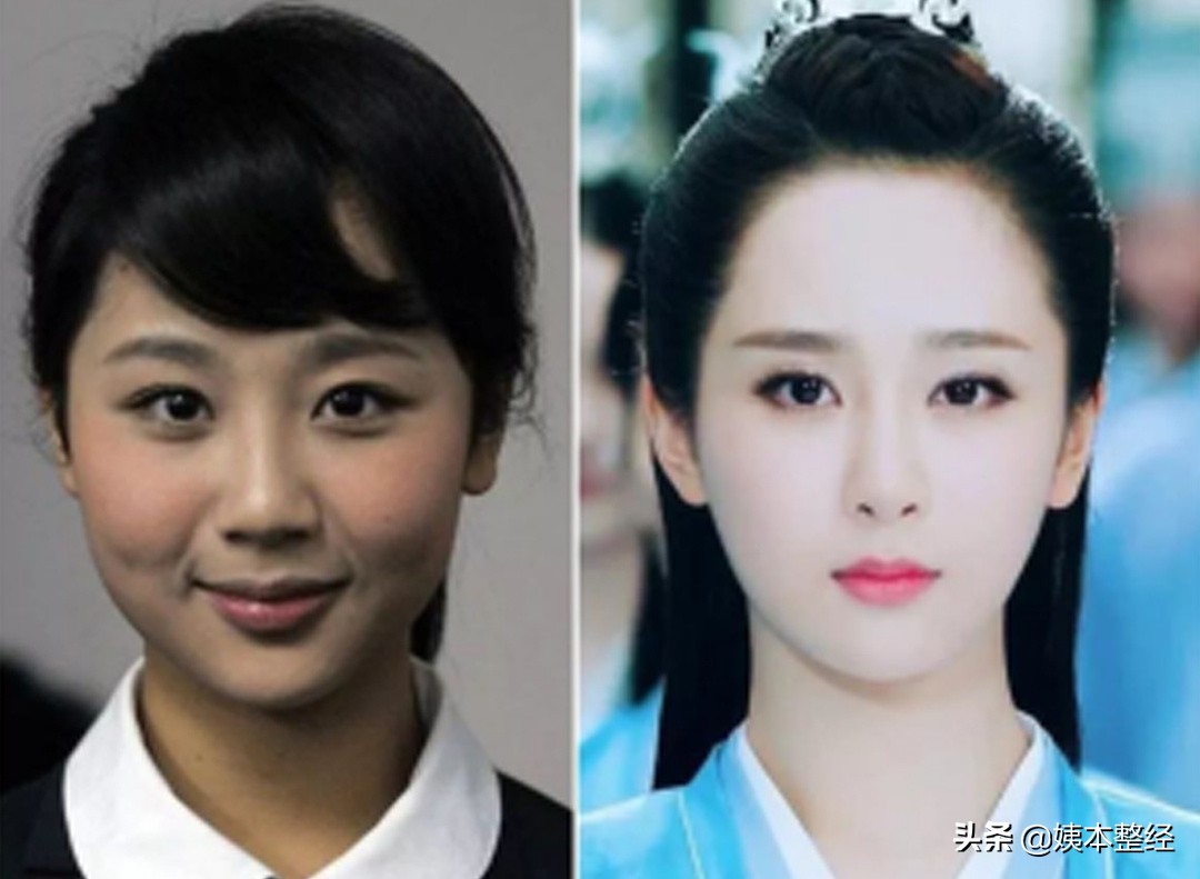 三个显土的长相特征，你中了几个？