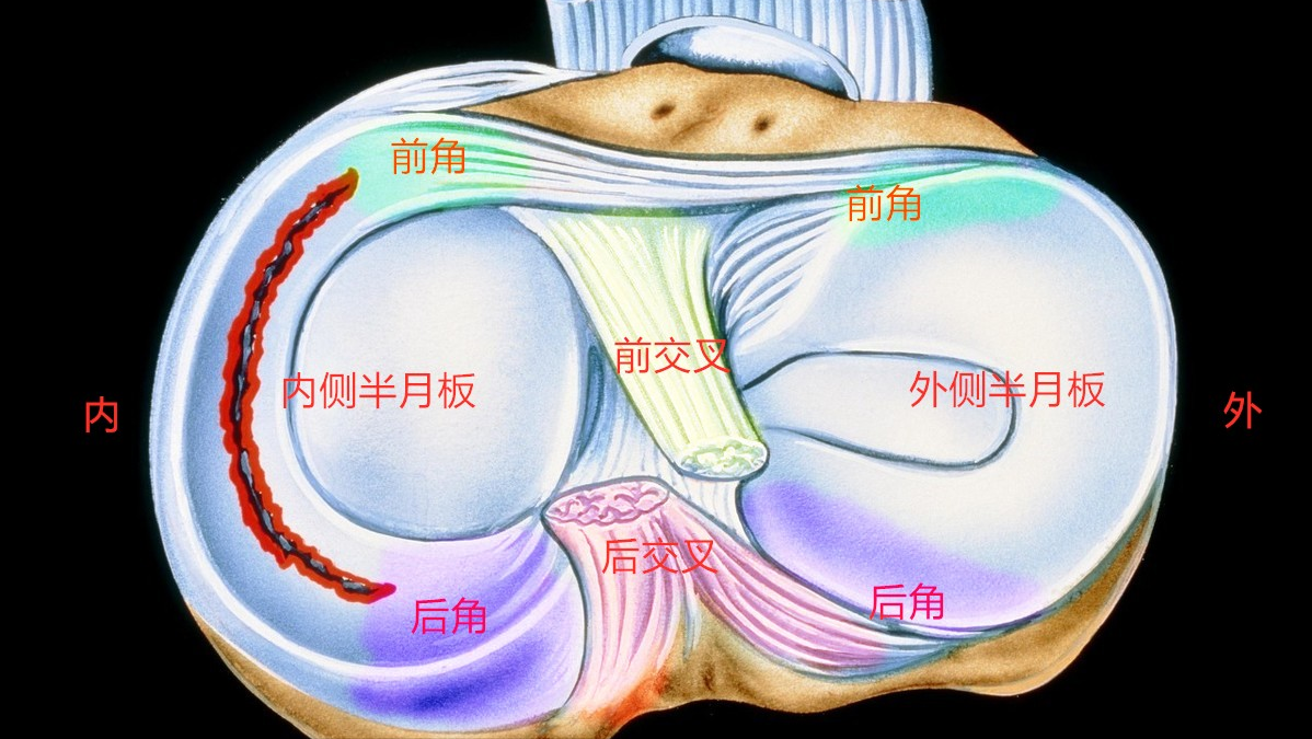 膝关节疼痛是怎么回事？不只是这3个病因，医生教你如何应对