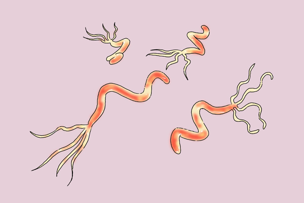 癌症化疗一般进行多少次？缓解化疗副作用，3个方法可以利用起来
