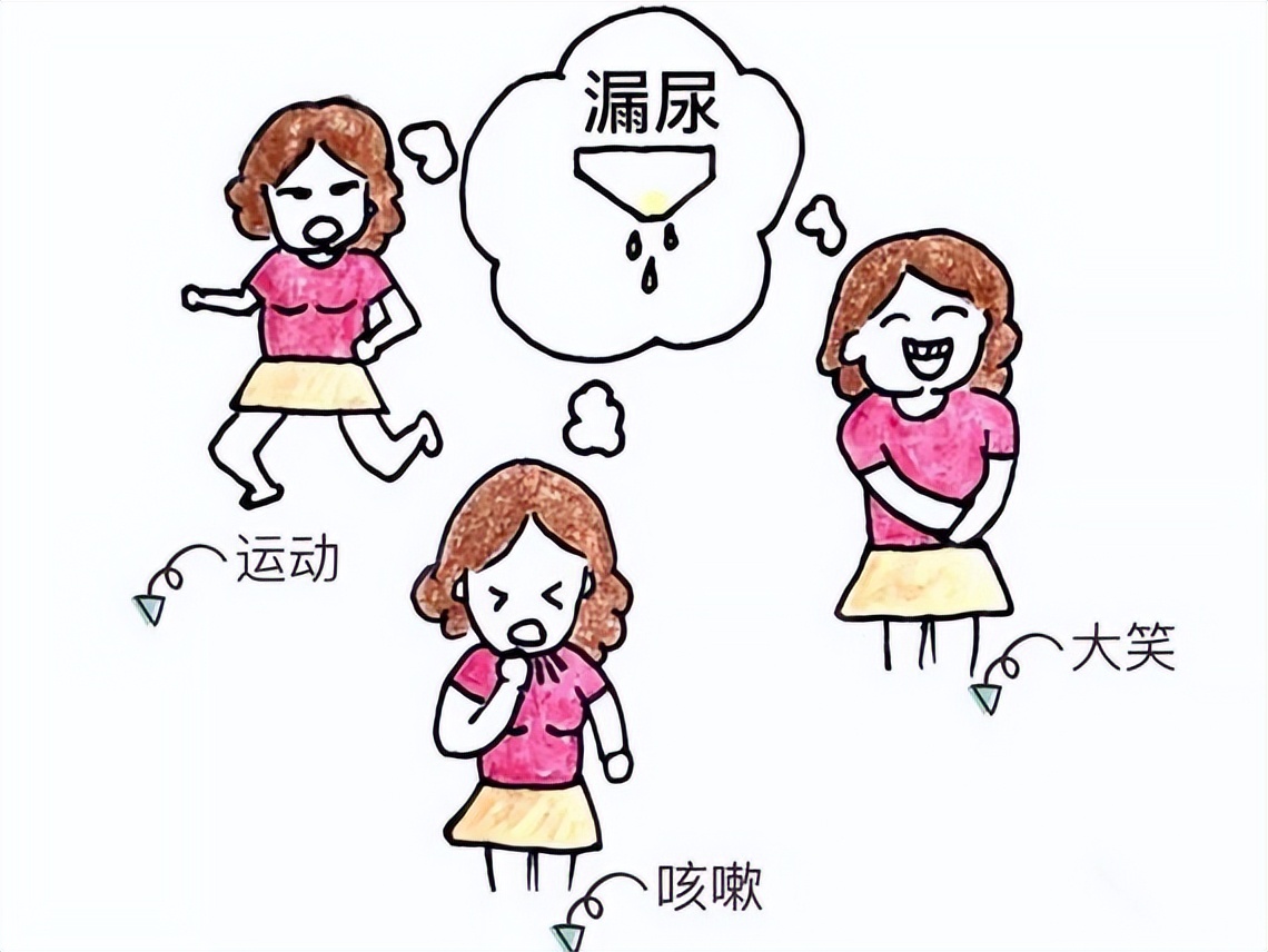 仁医科普丨运动咳嗽就“漏尿”？“尿失禁”好治，不要忍