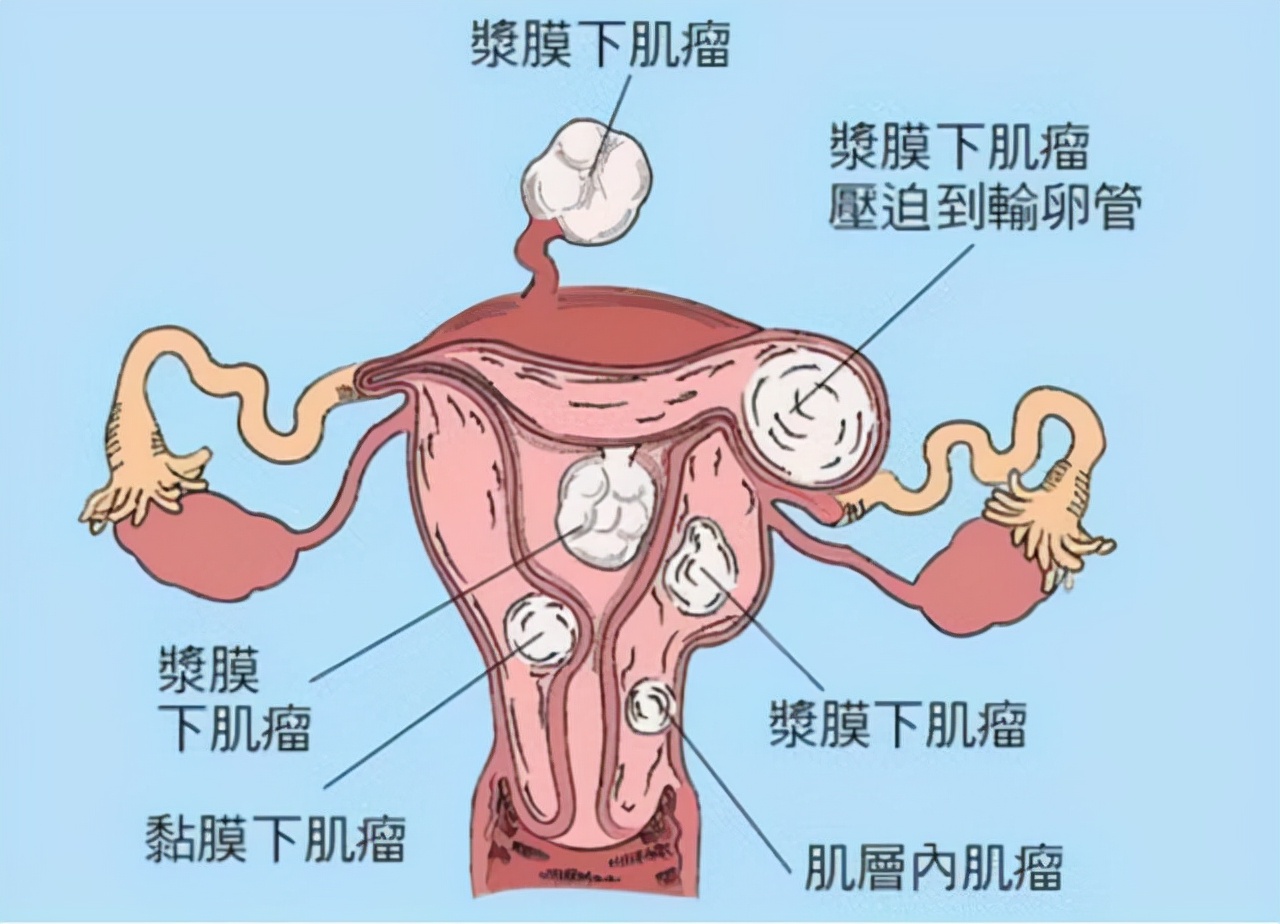 “大姨妈”总是提前，是哪里出了问题？女性朋友早了解，早调理