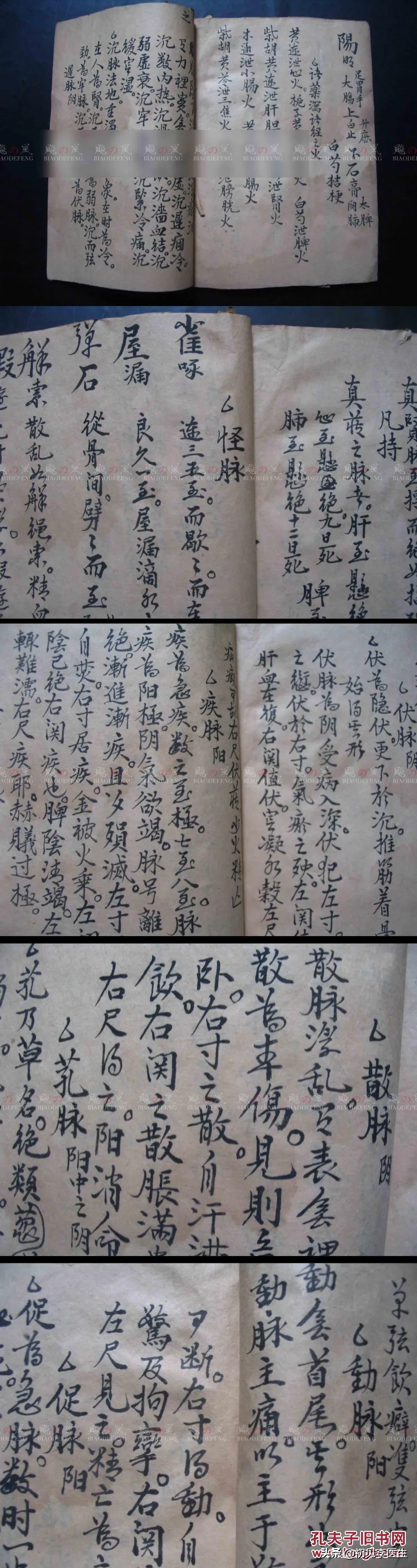 中医号脉最好的脉诊(普通人走进中医，普通人也能看懂号脉这点事儿，李医生大白话脉诊)