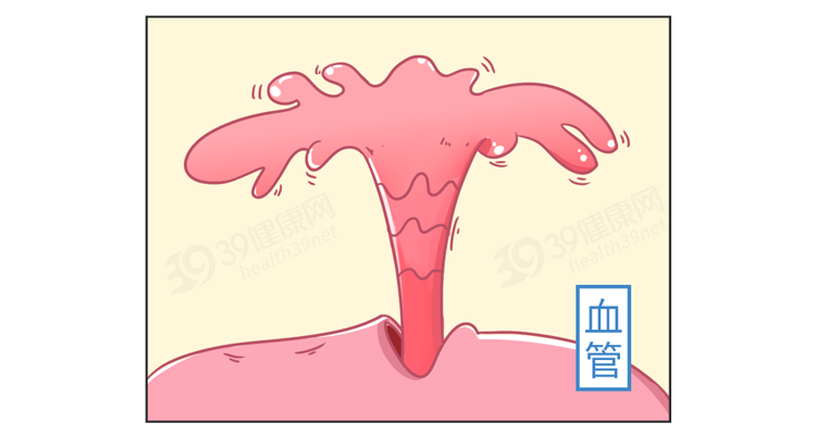 男性结扎和女性结扎，哪个伤害更大？男性结扎会降低性能力吗？