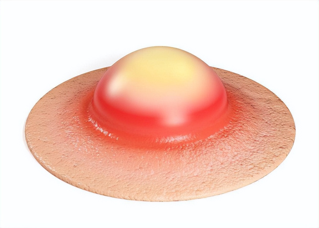 家中的3大卫生死角，竟是“病菌窝”？快看看你家有没有