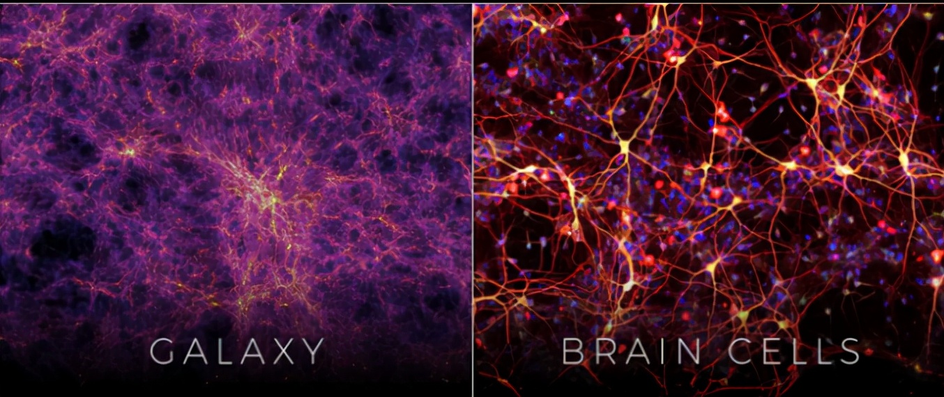 人类大脑和宇宙的相似之处