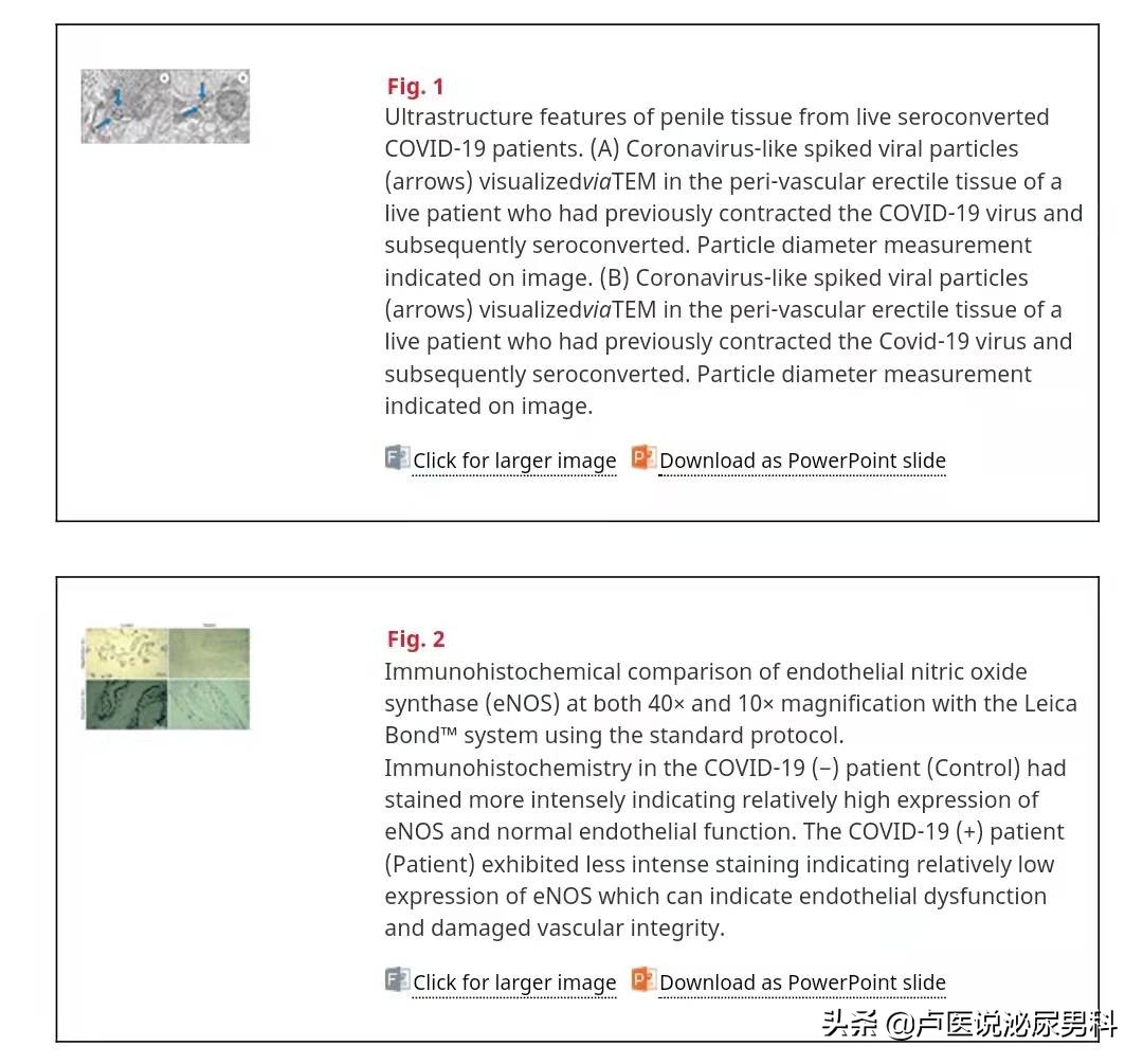 国外研究发现新冠会损伤男性性功能，包括勃起障碍，是真的吗？